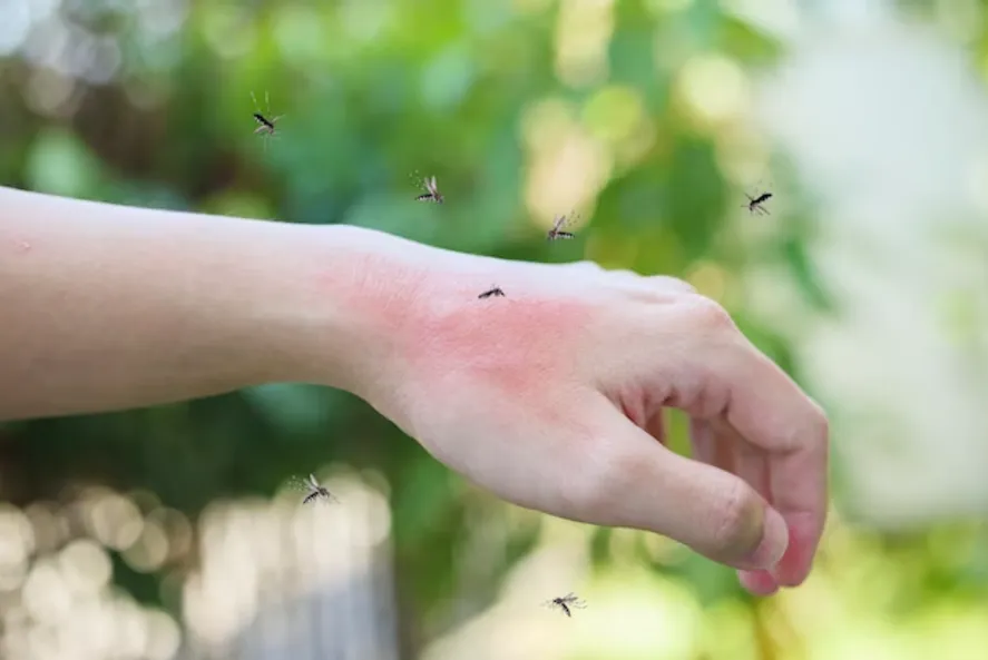 mosquitos-picadura-png